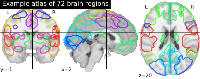 ../../_images/sphx_glr_plot_import_atlas_example_001.png