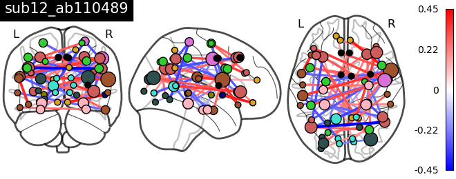 ../../_images/sphx_glr_plot_individual_statistics_in_the_tangent_space_005.png